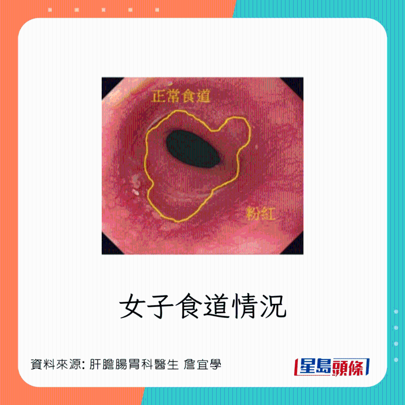 女患者情況正常