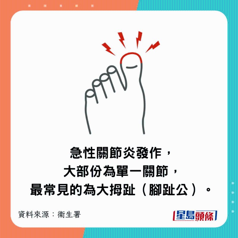 急性關節炎發作，大部份為單一關節，最常見的為大拇趾（腳趾公）