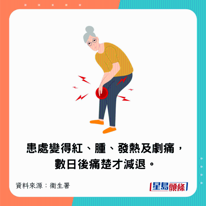 患處突然變得紅、腫、發熱及劇痛，數日后痛楚才減退。