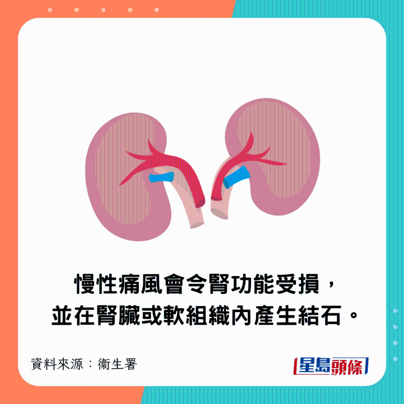 慢性痛風會令腎功能受損，并在腎臟或軟組織內產生結石。