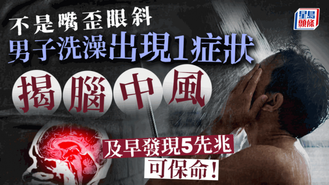 中風先兆 中風先兆