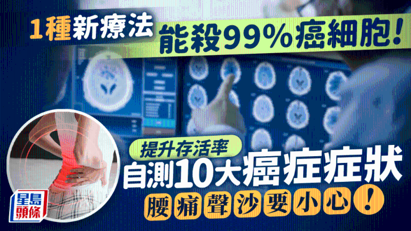 癌癥治療 癌癥治療