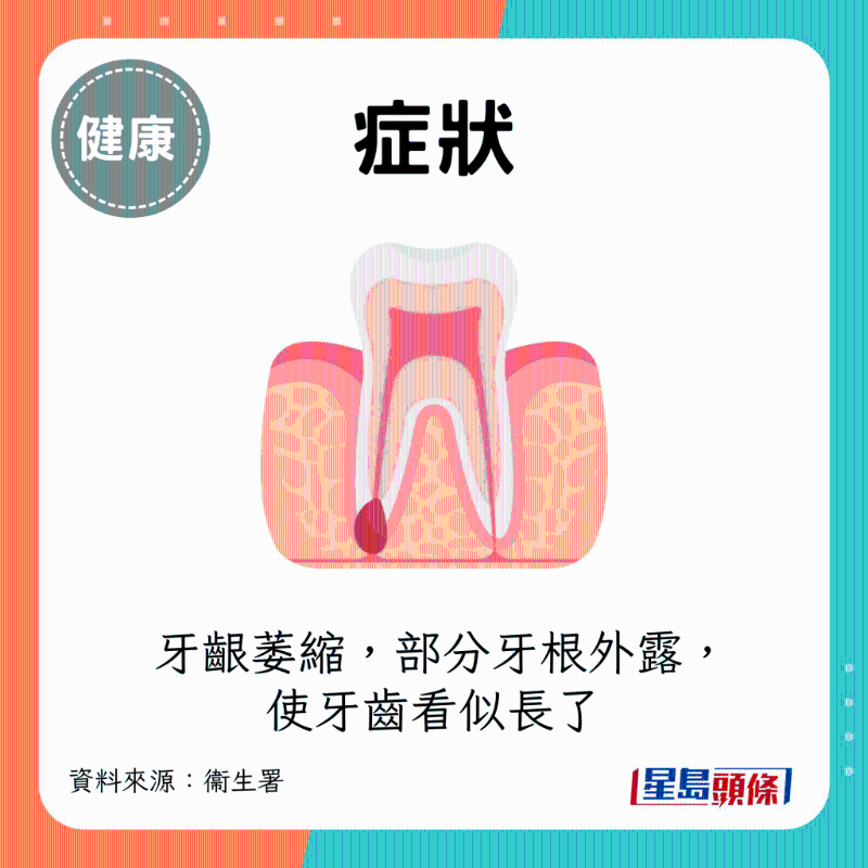 牙齦萎縮 牙齦萎縮