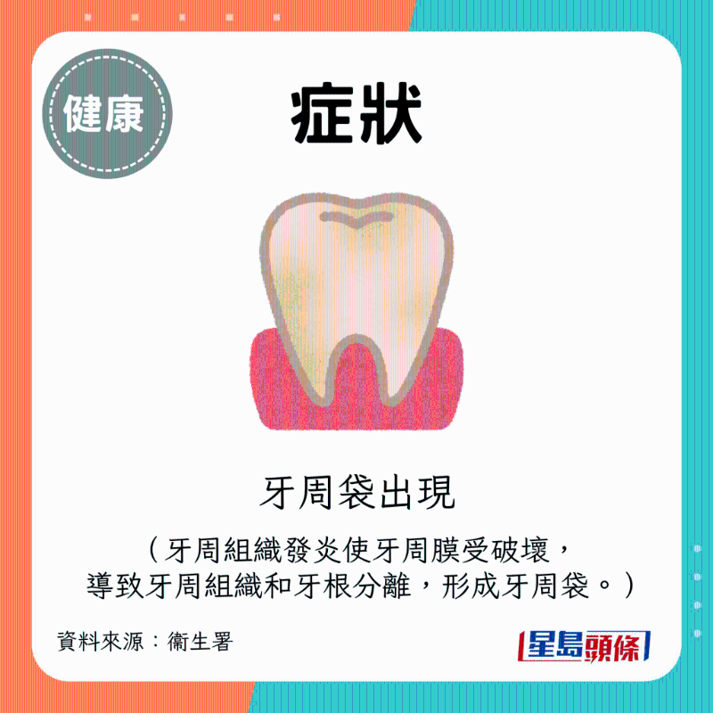 牙周袋出現 牙周袋出現