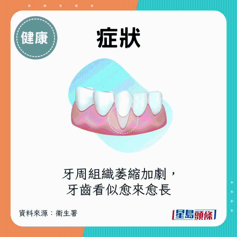 牙周組織萎縮加劇 牙周組織萎縮加劇