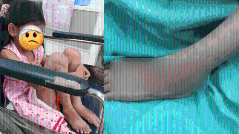 網民爆料附上受害女童傷勢照片。