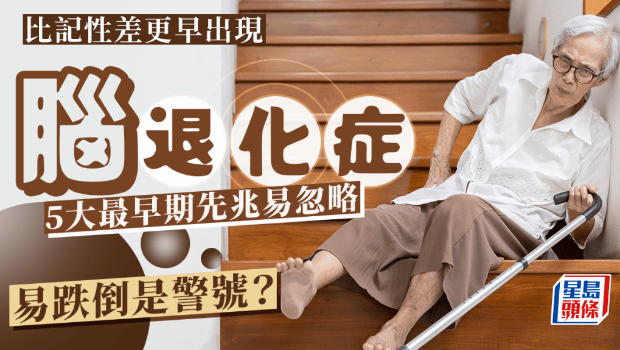 腦退化癥 腦退化癥