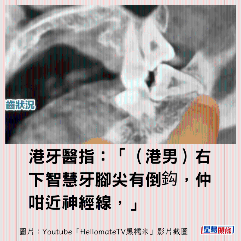 港牙醫指深圳牙醫犯三大錯12 港牙醫指深圳牙醫犯三大錯12