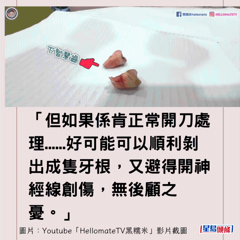 港牙醫指深圳牙醫犯三大錯6 港牙醫指深圳牙醫犯三大錯6