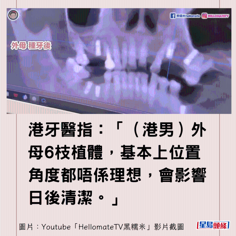 港牙醫指深圳牙醫犯三大錯4 港牙醫指深圳牙醫犯三大錯4