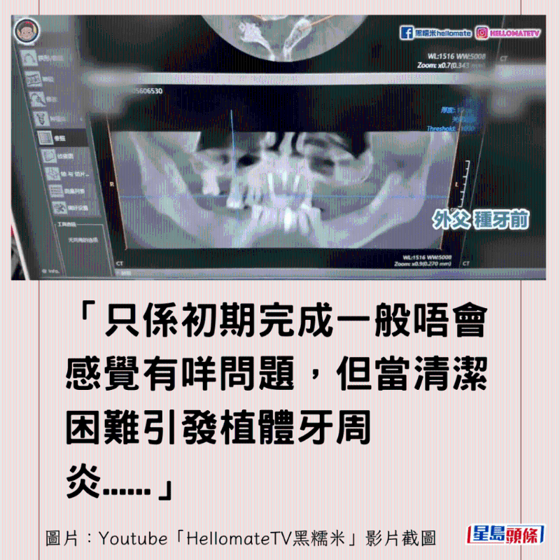 港牙醫指深圳牙醫犯三大錯2 港牙醫指深圳牙醫犯三大錯2