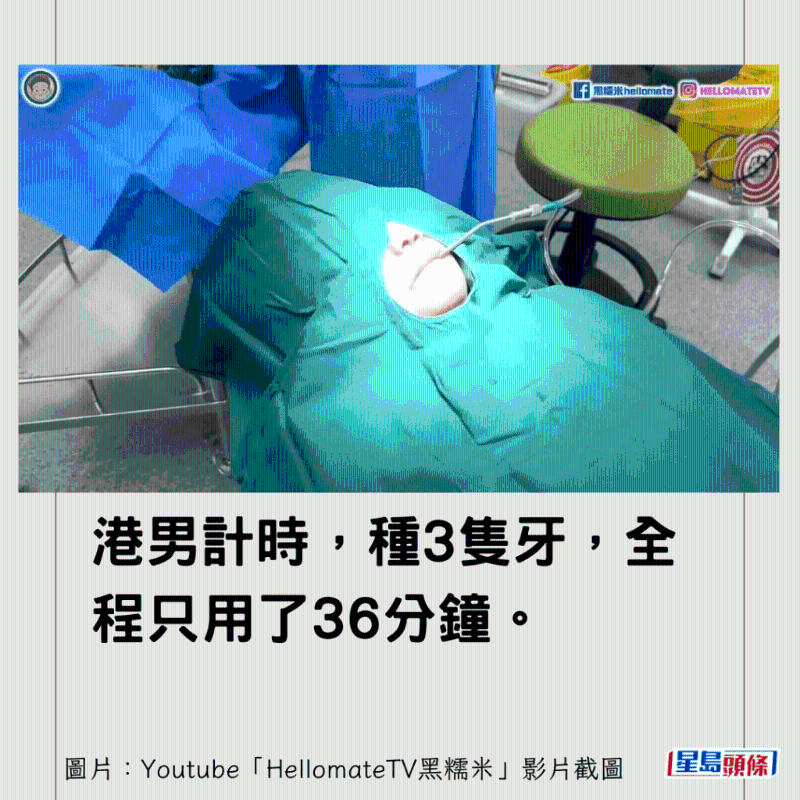香港男子實測深圳平價洗牙種牙9 香港男子實測深圳平價洗牙種牙9