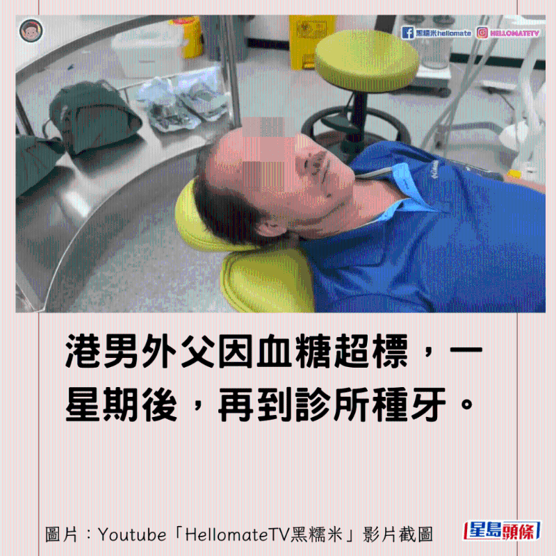 香港男子實測深圳平價洗牙種牙6 香港男子實測深圳平價洗牙種牙6