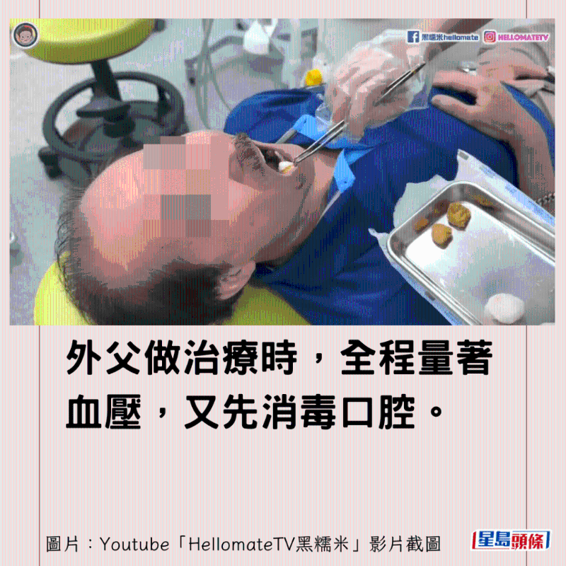 香港男子實測深圳平價洗牙種牙5 香港男子實測深圳平價洗牙種牙5