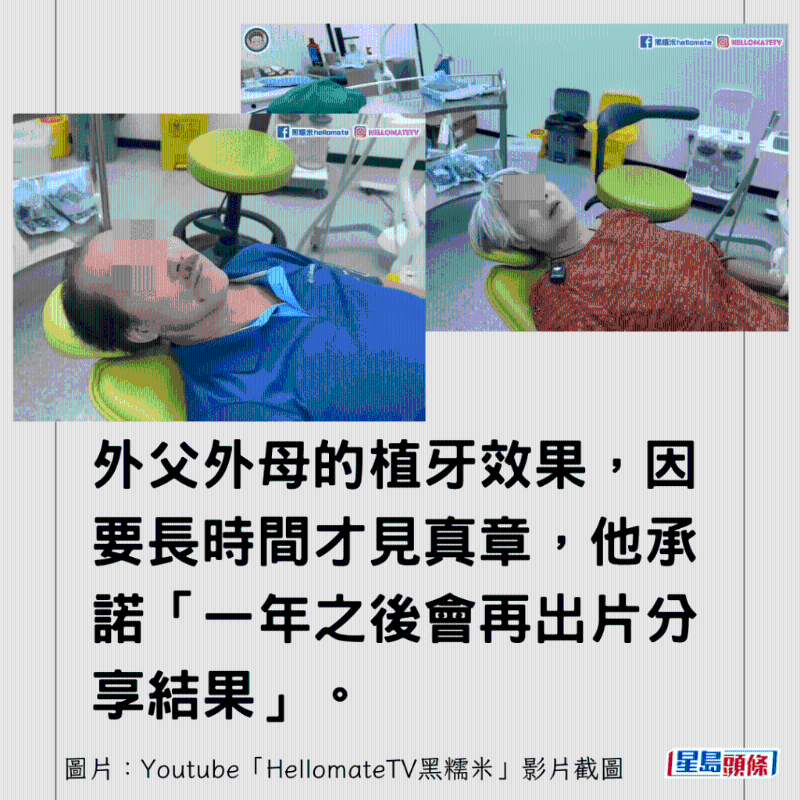 香港男子實測深圳平價洗牙種牙2 香港男子實測深圳平價洗牙種牙2