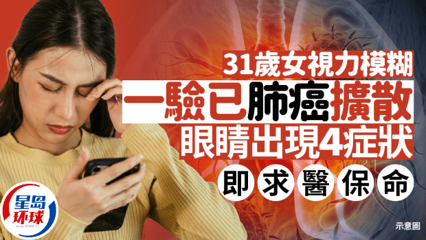 視力模糊 視力模糊