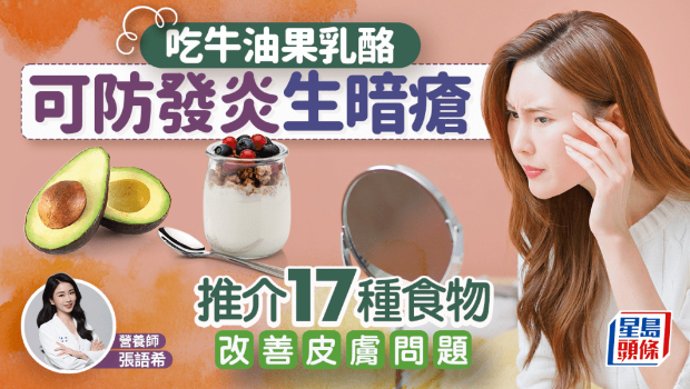 吃牛油果奶酪可防發炎生暗瘡？