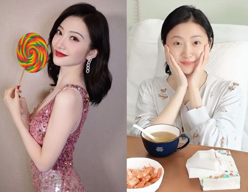 景甜證實動腿部手術 景甜證實動腿部手術