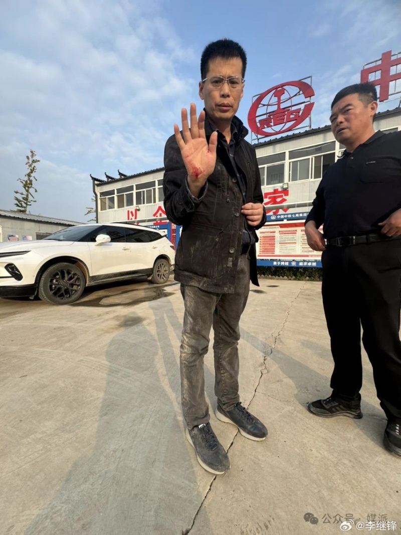 王文志右手受傷流血。(微博)