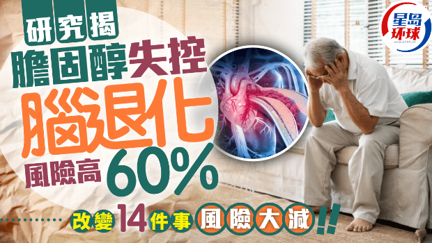 防腦退化 防腦退化