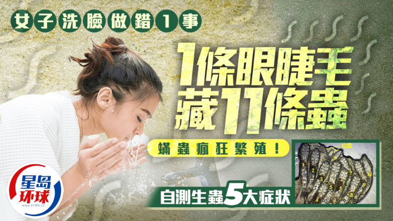 自測生蟲5大癥狀 自測生蟲5大癥狀