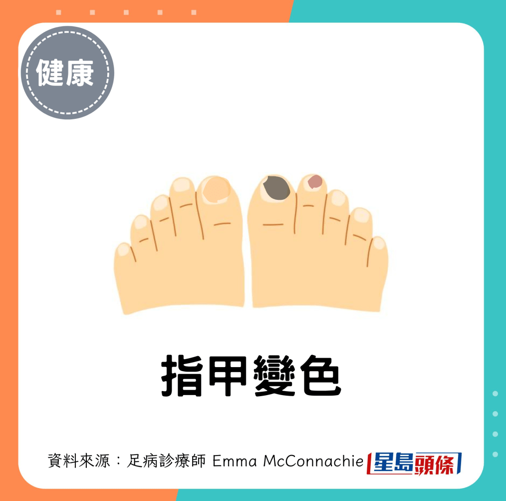 腳趾甲變色 腳趾甲變色