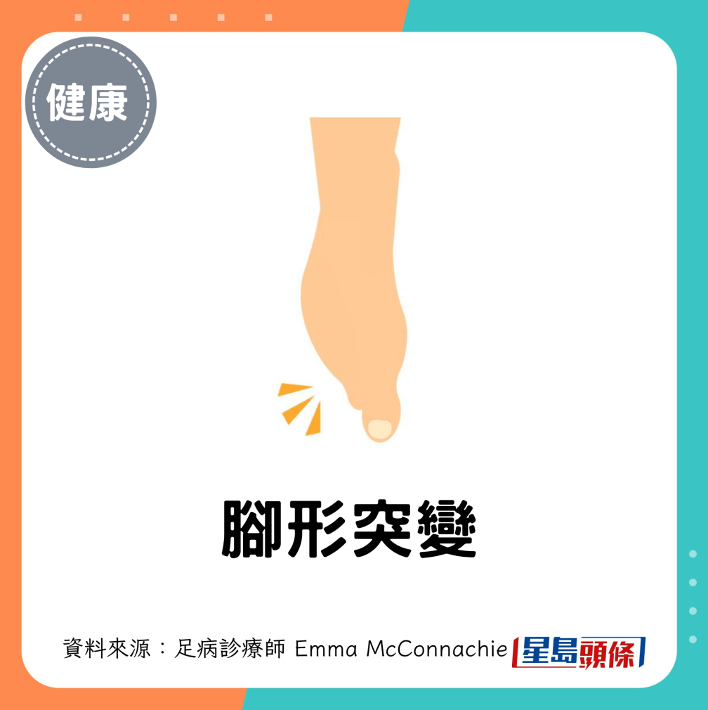 腳形突變 腳形突變