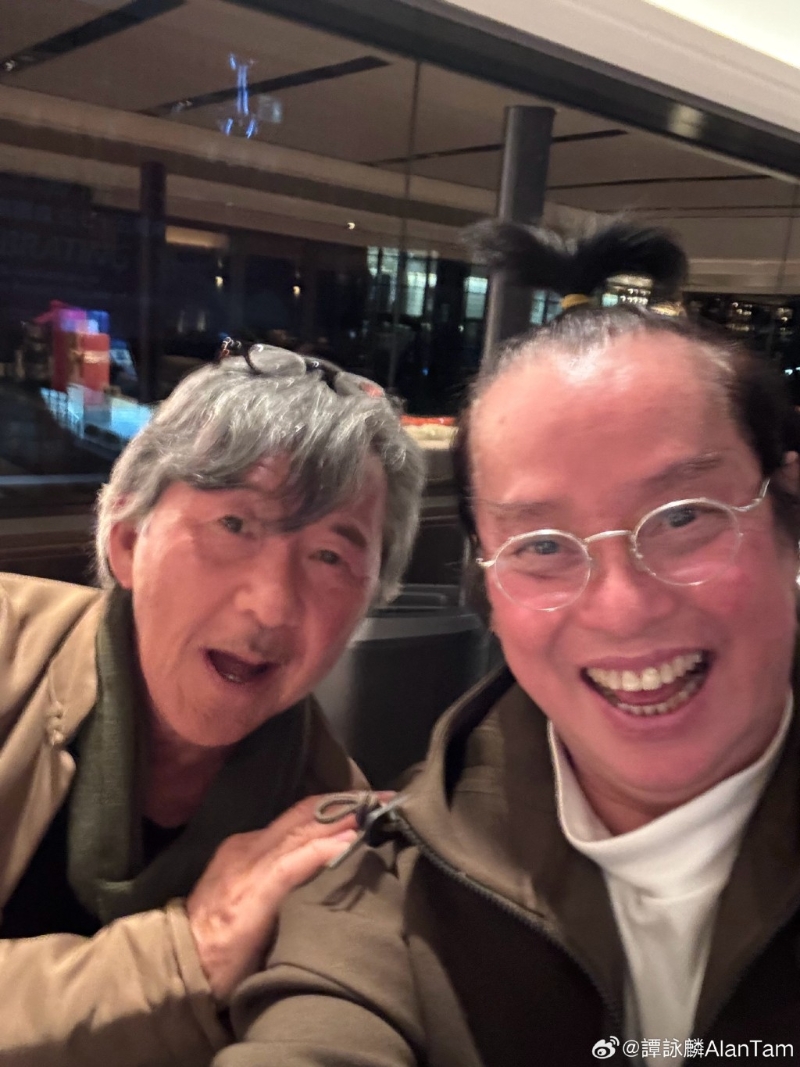 其他網民則留言：「阿倫你的發際線是心形」、「那是愛我們的形狀」、「美人尖」。