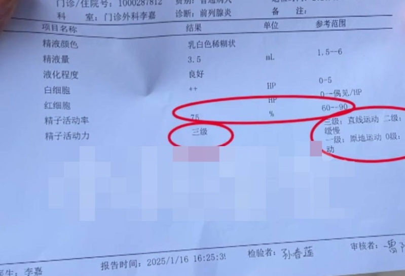 醫院人員解釋李先生精子太活躍?！缎±驇兔Α奉l道