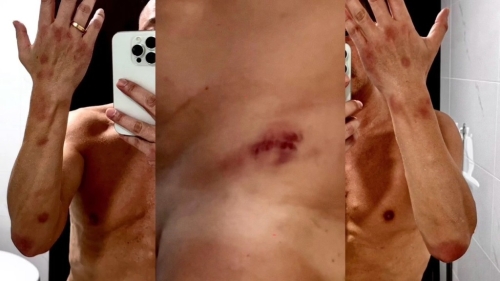 王喜全身滿布血痕。