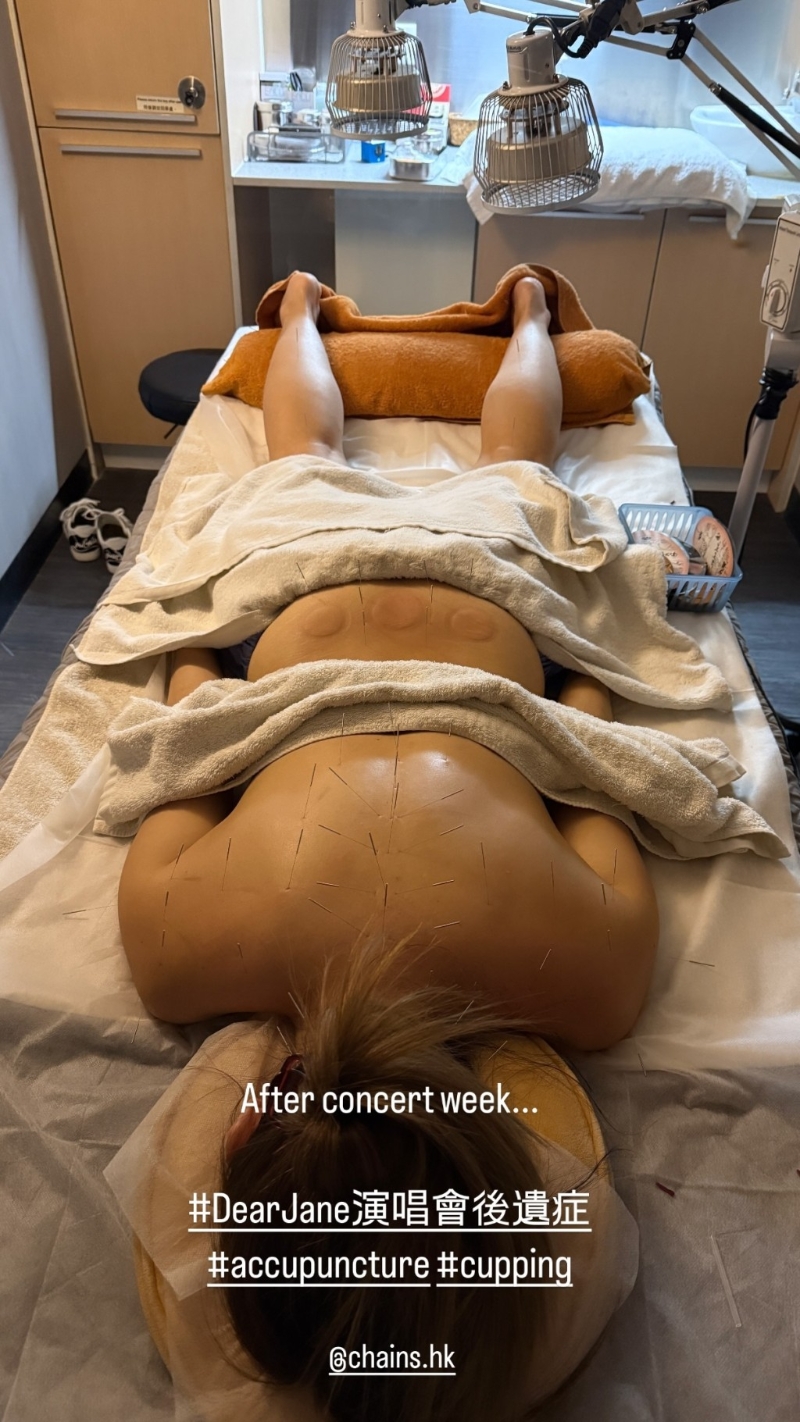 楊洛婷到醫療中心針炙和拔罐，畫面觸目驚心。
