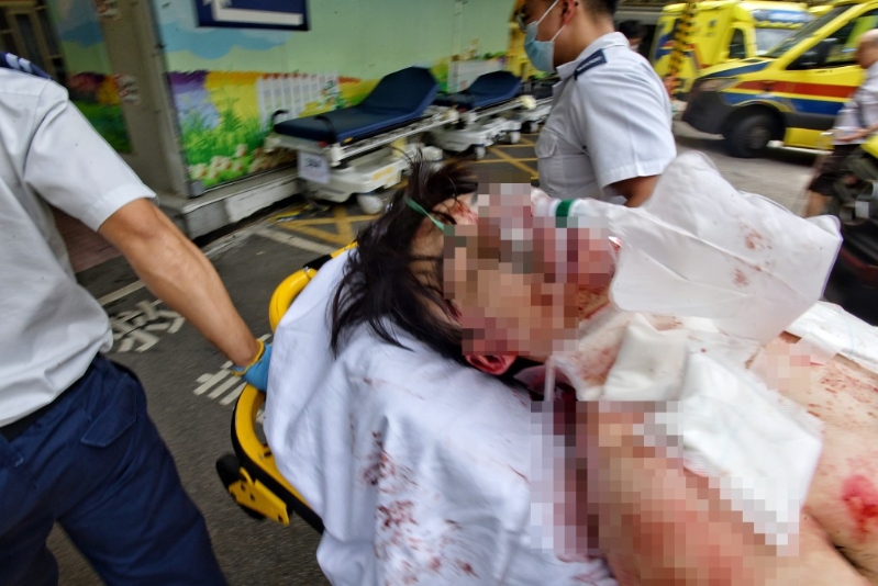 傷者送院搶救。